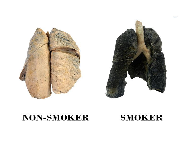 Smoker plastinated lungs