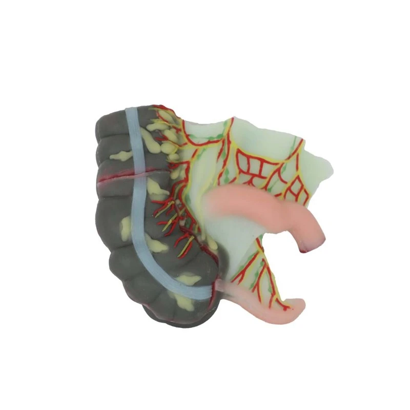 Soft Appendices and Cecum Model Soft Appendices and Cecum Model
