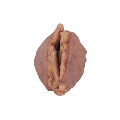 Breast Cancer Model