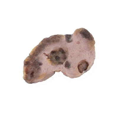 Ovarian Cancer Anatomy Model