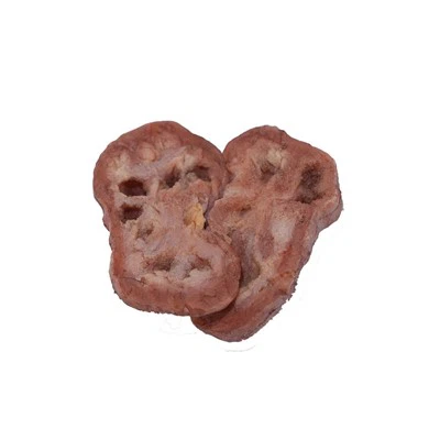 Renal Tuberculosis Pathology Model